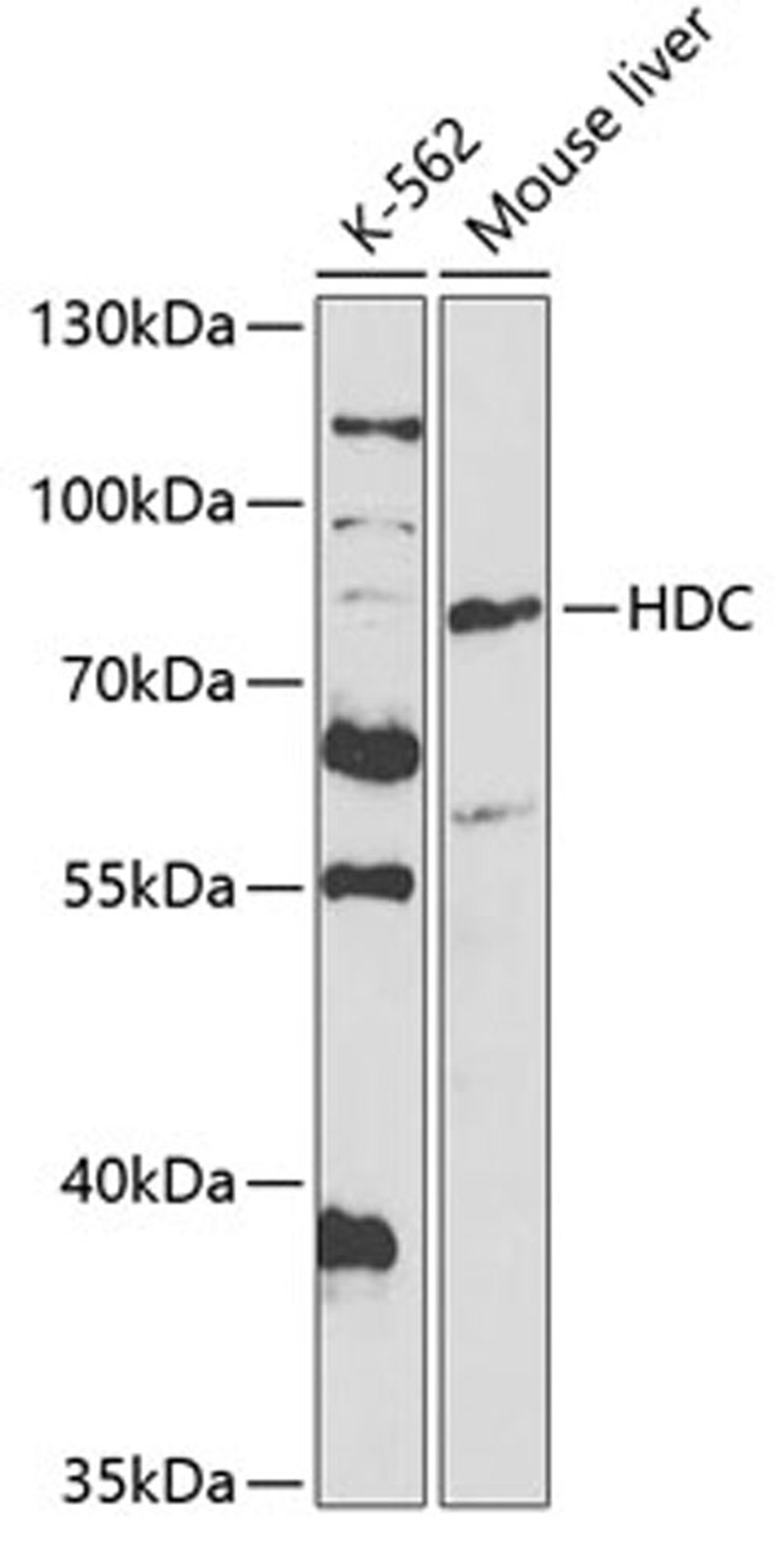 Western blot - HDC antibody (A5465)