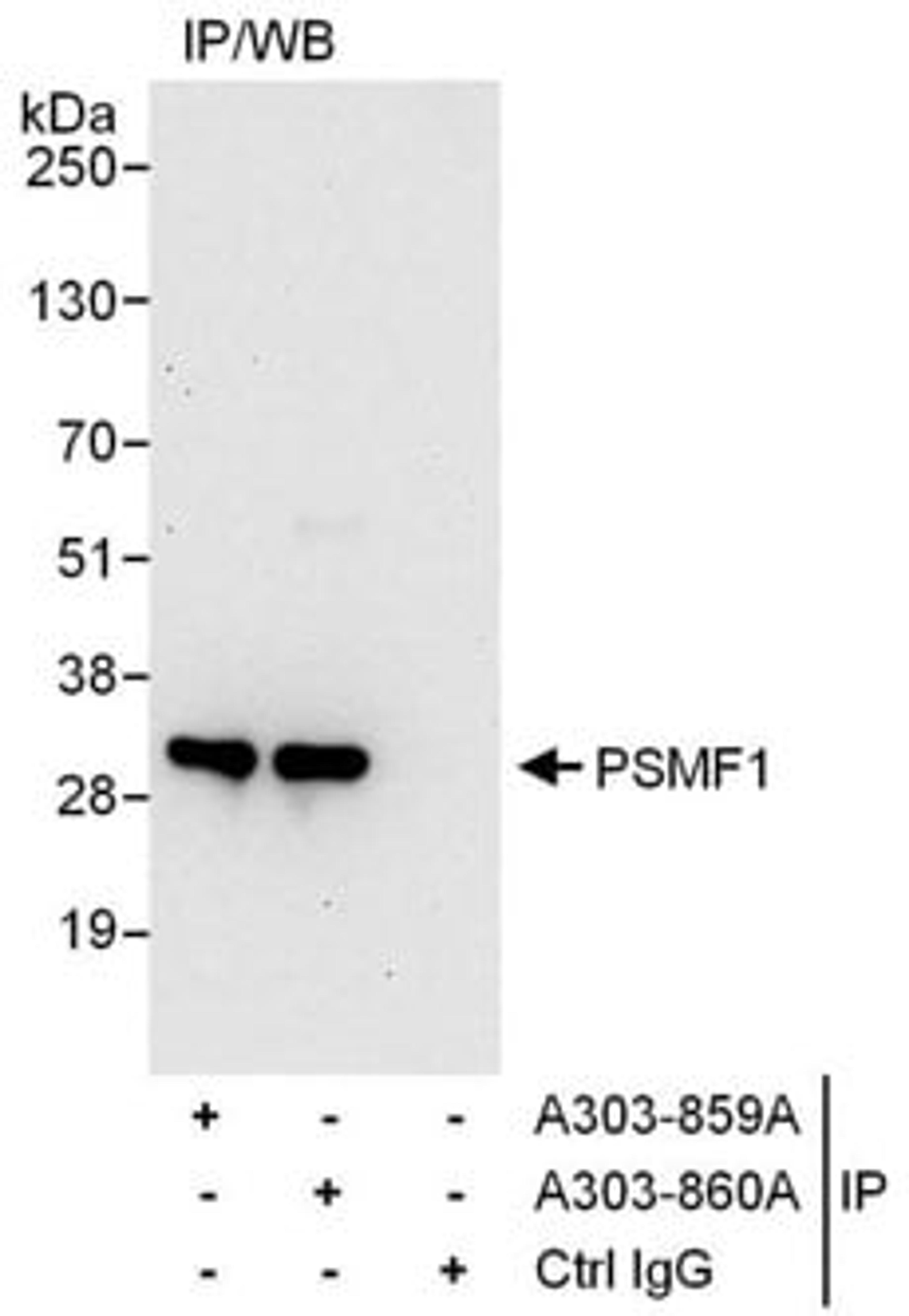 Detection of human PSMF1 by western blot of immunoprecipitates.