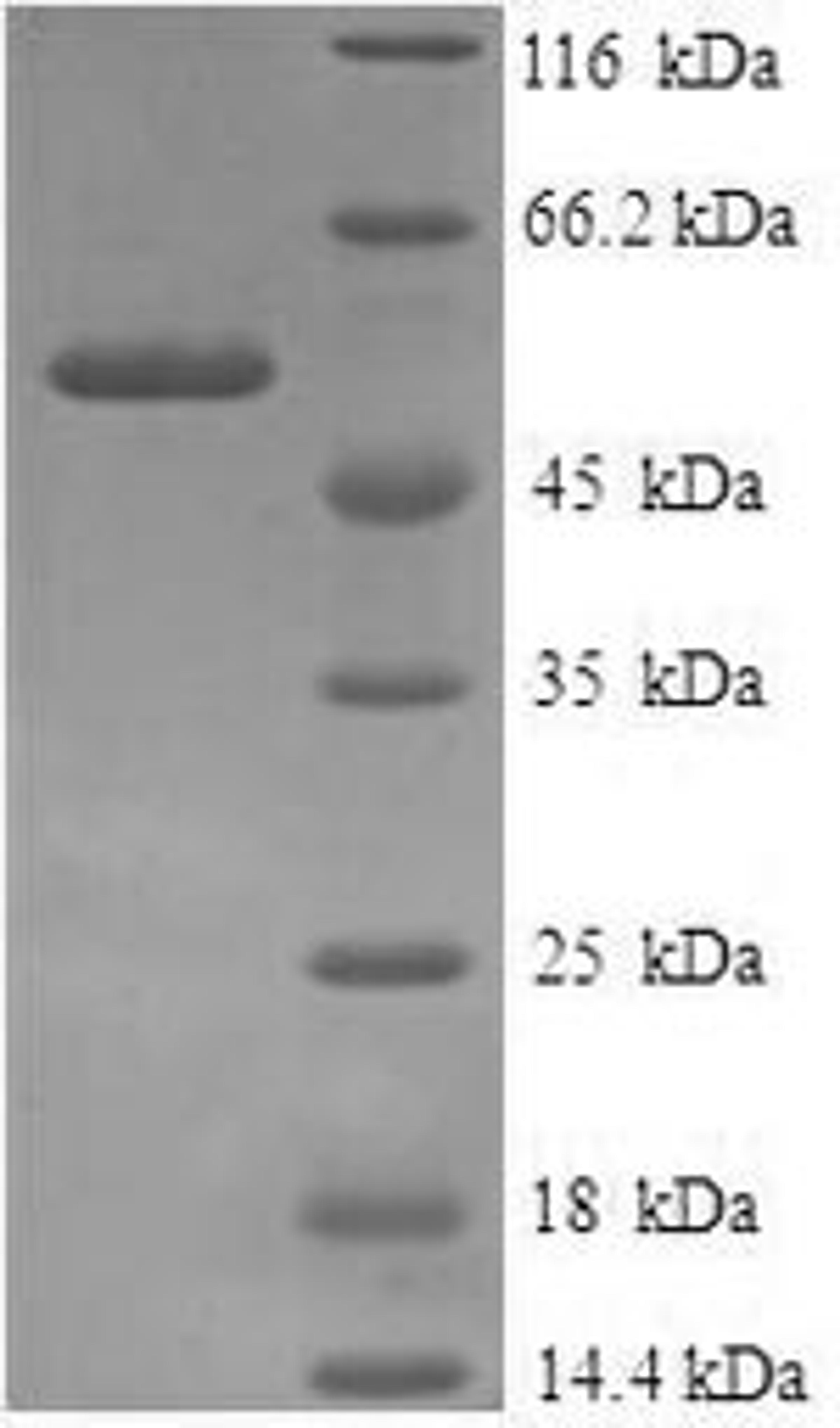 (Tris-Glycine gel) Discontinuous SDS-PAGE (reduced) with 5% enrichment gel and 15% separation gel.