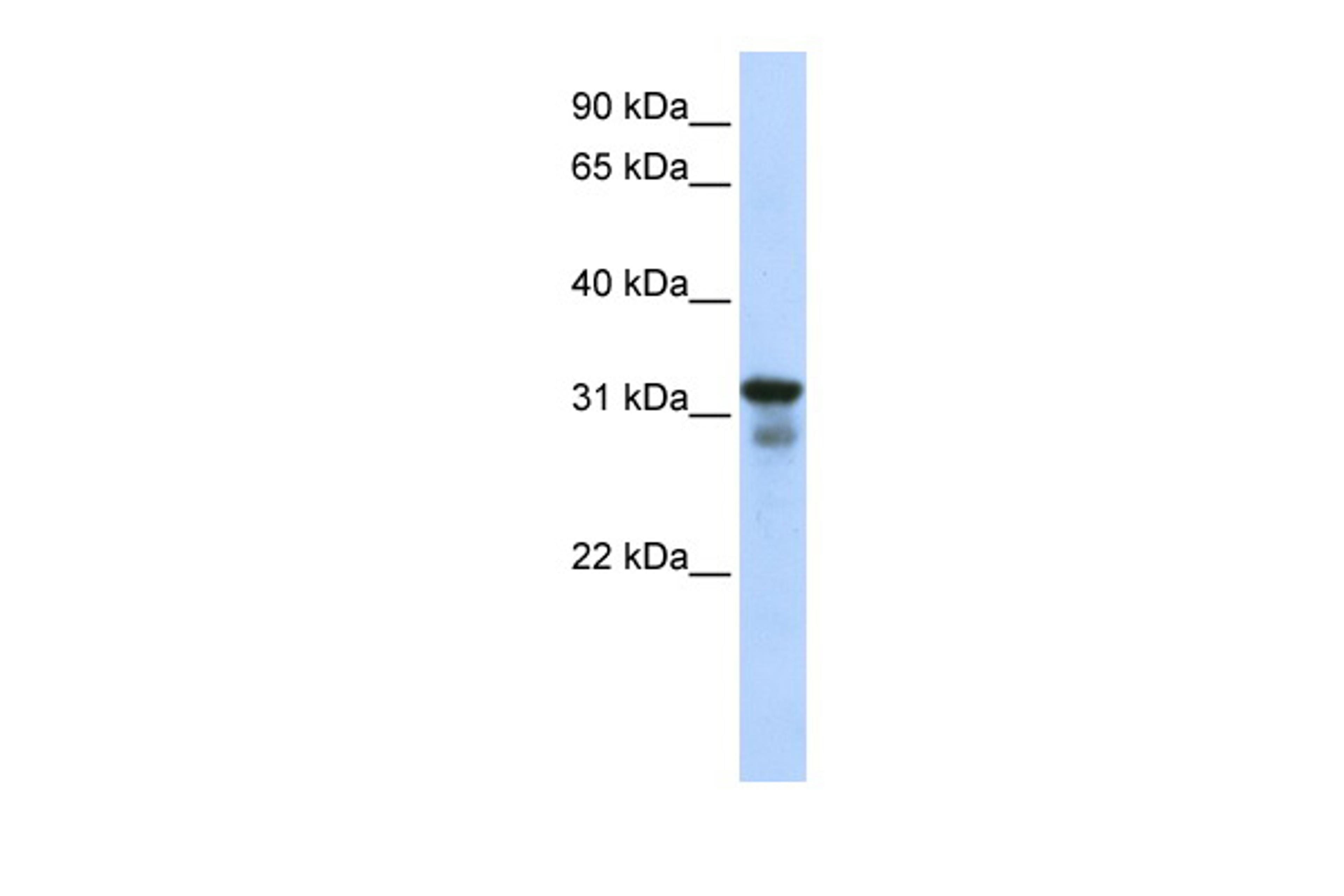 Antibody used in WB on Human 293T at 0.2-1 ug/ml.