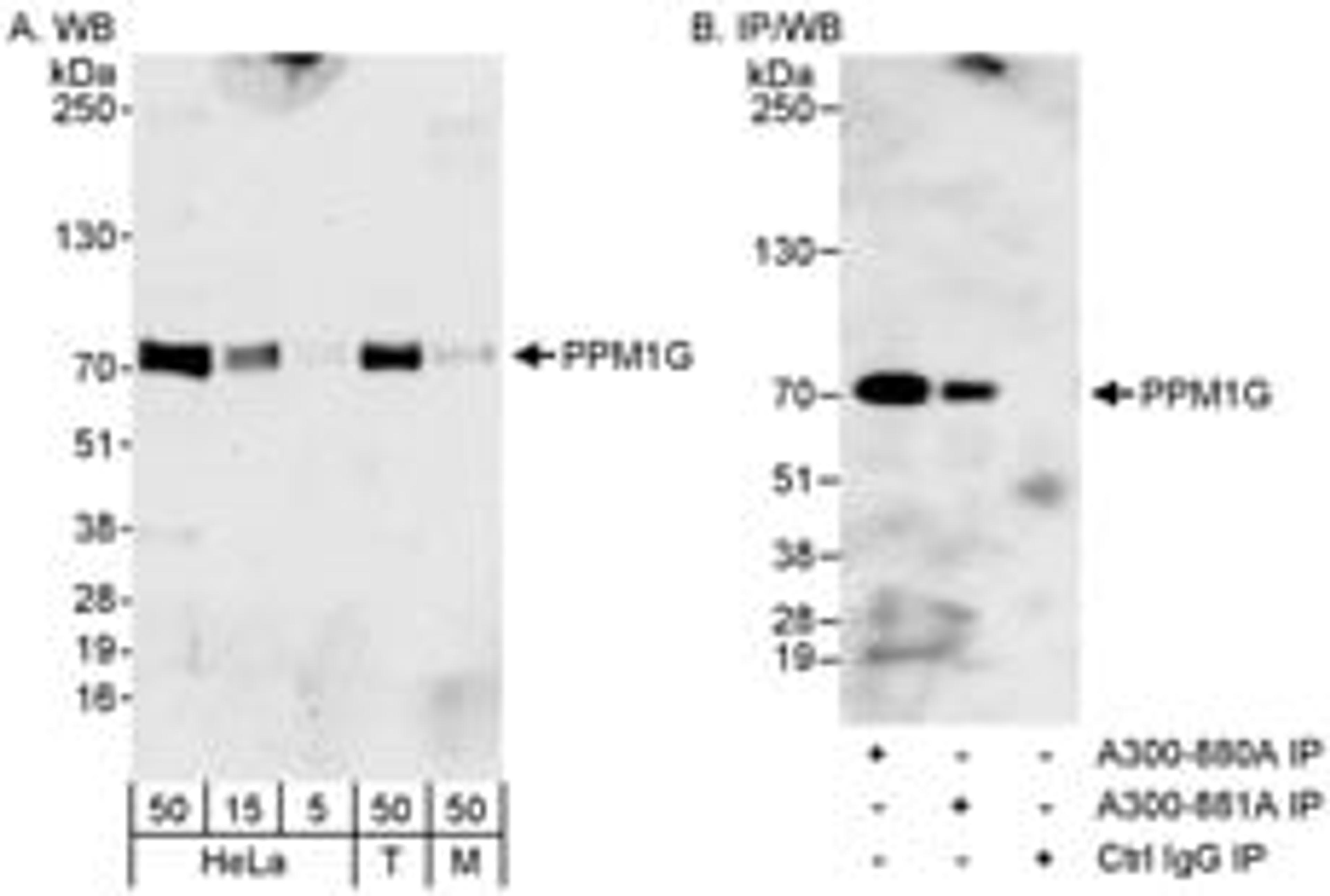 Detection of human and mouse PPM1G by western blot (h&m) and immunoprecipitation (h).