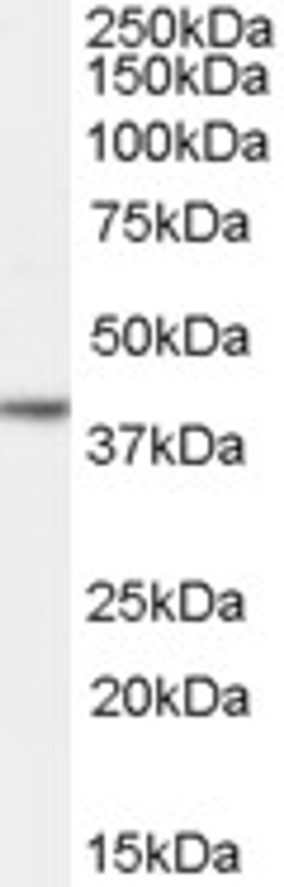 45-931 (0.03ug/ml) staining of Human Ovary lysate (35ug protein in RIPA buffer). Detected by chemiluminescence.