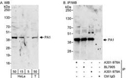 Detection of human PA1 by western blot and immunoprecipitation.