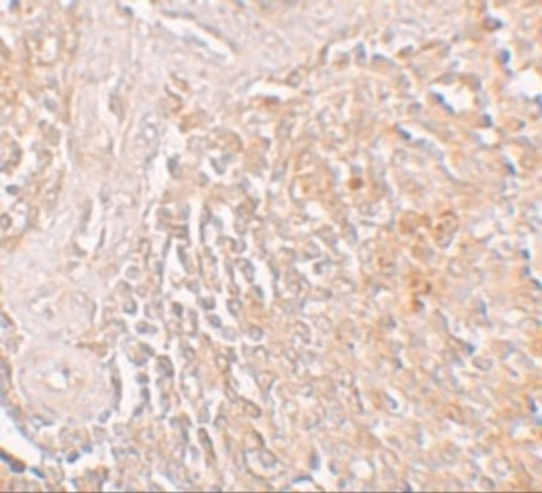 Immunohistochemistry: SLC39A8/ZIP8 Antibody [NBP1-76505] - Immunohistochemistry of ZIP8 in human spleen tissue with ZIP8 antibody at 5 ug/mL.