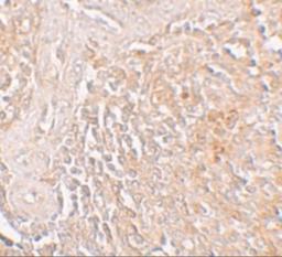 Immunohistochemistry: SLC39A8/ZIP8 Antibody [NBP1-76505] - Immunohistochemistry of ZIP8 in human spleen tissue with ZIP8 antibody at 5 ug/mL.