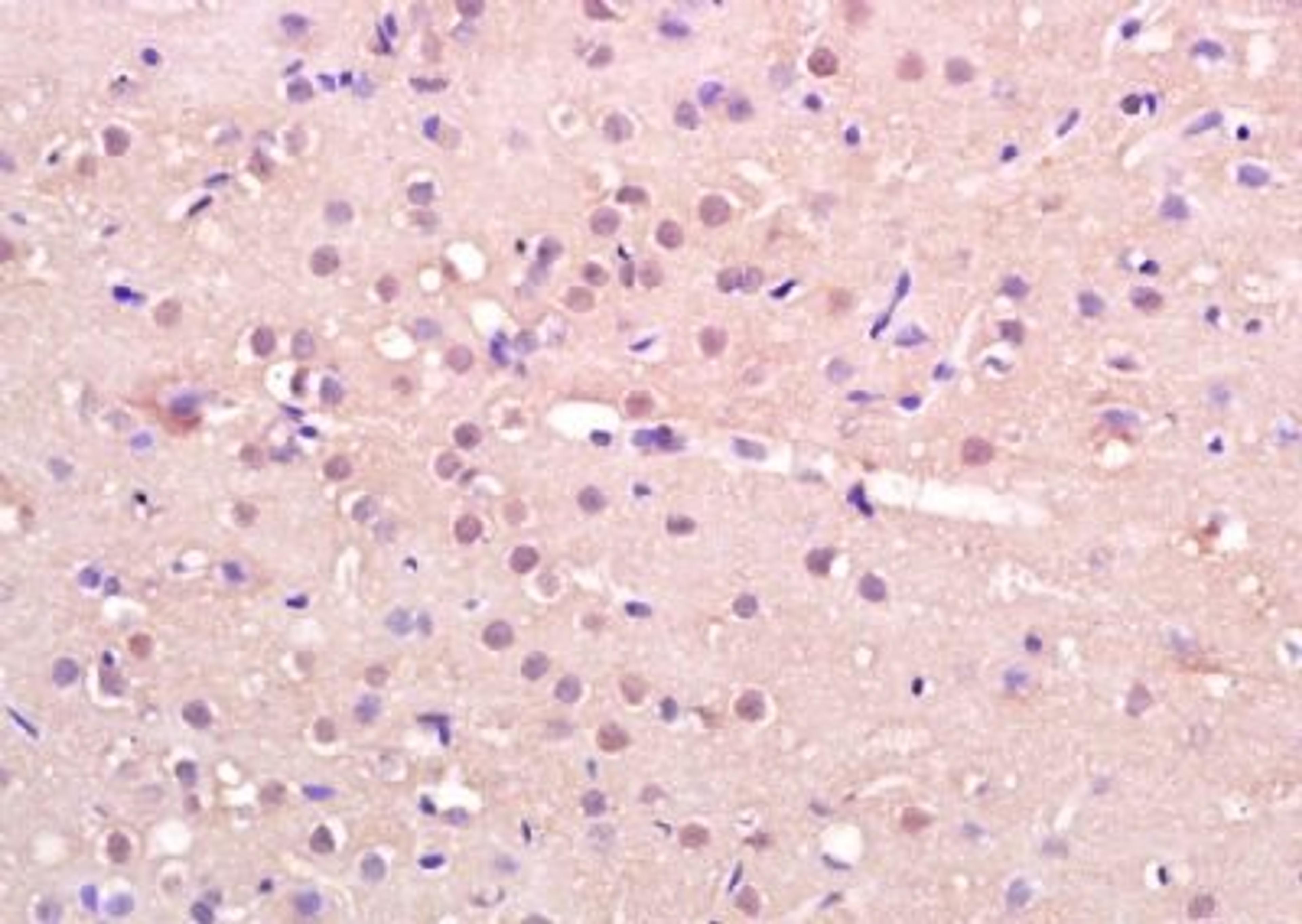 Immunohistochemical analysis of formalin-fixed paraffin embedded rat brain tissue using IRX4 antibody (dilution at 1:200)