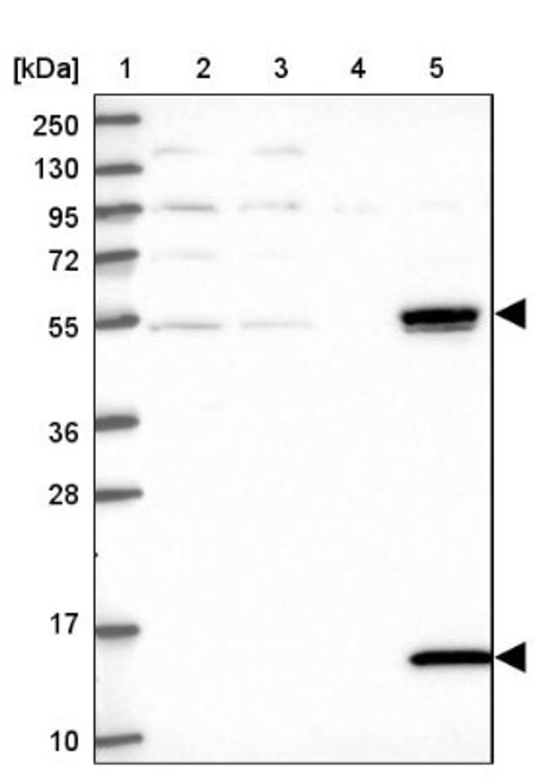 Western Blot: UFSP2 Antibody [NBP1-86781] - Lane 1: Marker [kDa] 250, 130, 95, 72, 55, 36, 28, 17, 10<br/>Lane 2: Human cell line RT-4<br/>Lane 3: Human cell line U-251MG sp<br/>Lane 4: Human plasma (IgG/HSA depleted)<br/>Lane 5: Human liver tissue