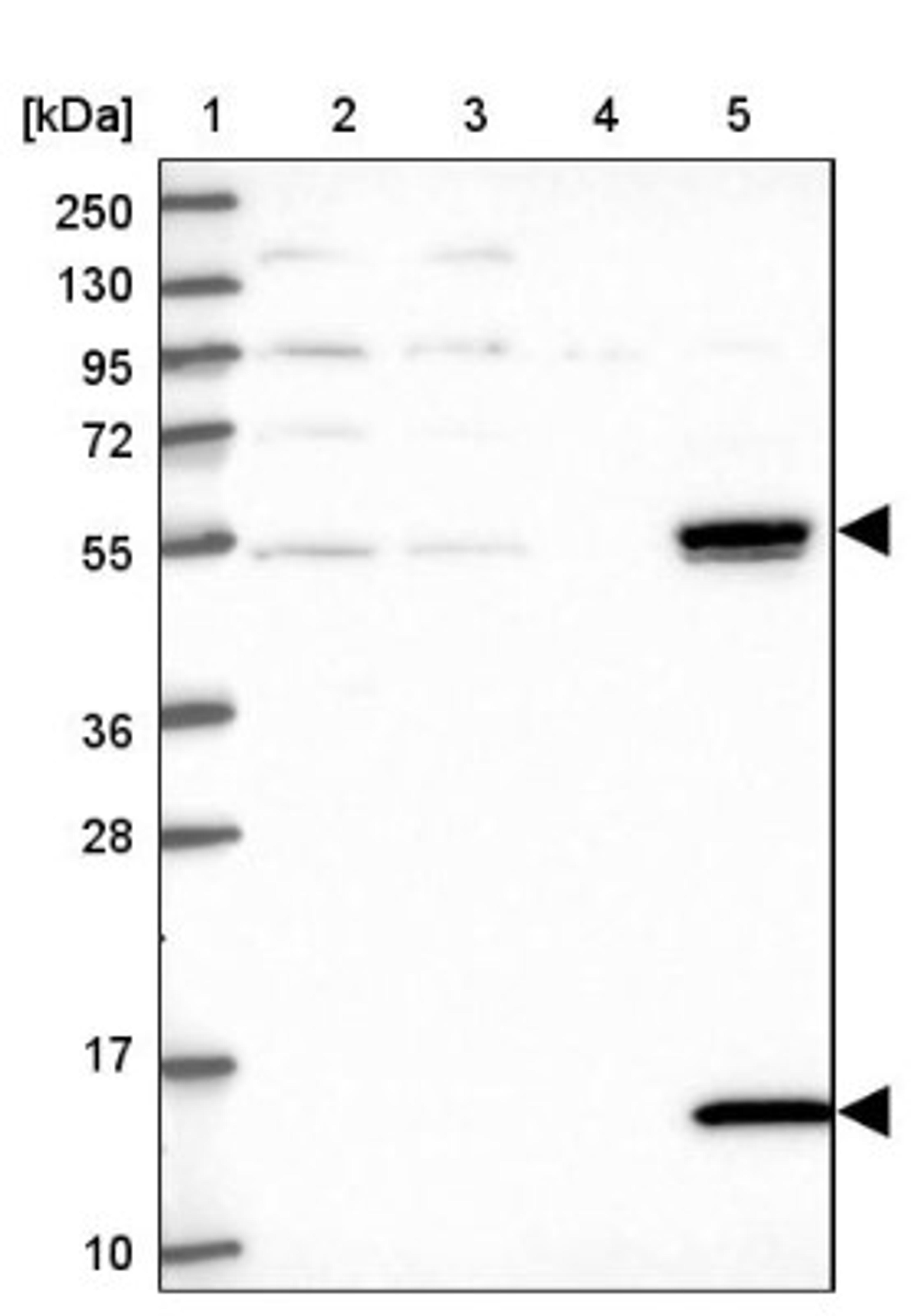 Western Blot: UFSP2 Antibody [NBP1-86781] - Lane 1: Marker [kDa] 250, 130, 95, 72, 55, 36, 28, 17, 10<br/>Lane 2: Human cell line RT-4<br/>Lane 3: Human cell line U-251MG sp<br/>Lane 4: Human plasma (IgG/HSA depleted)<br/>Lane 5: Human liver tissue