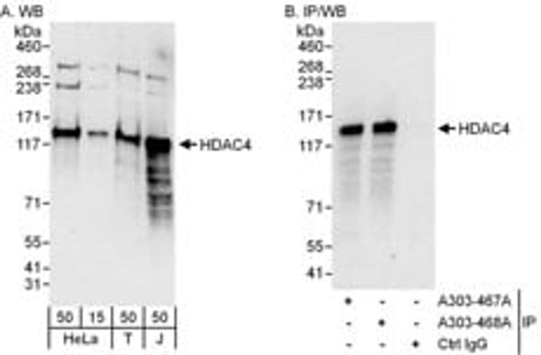 Detection of human HDAC4 by western blot and immunoprecipitation.