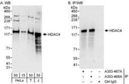 Detection of human HDAC4 by western blot and immunoprecipitation.