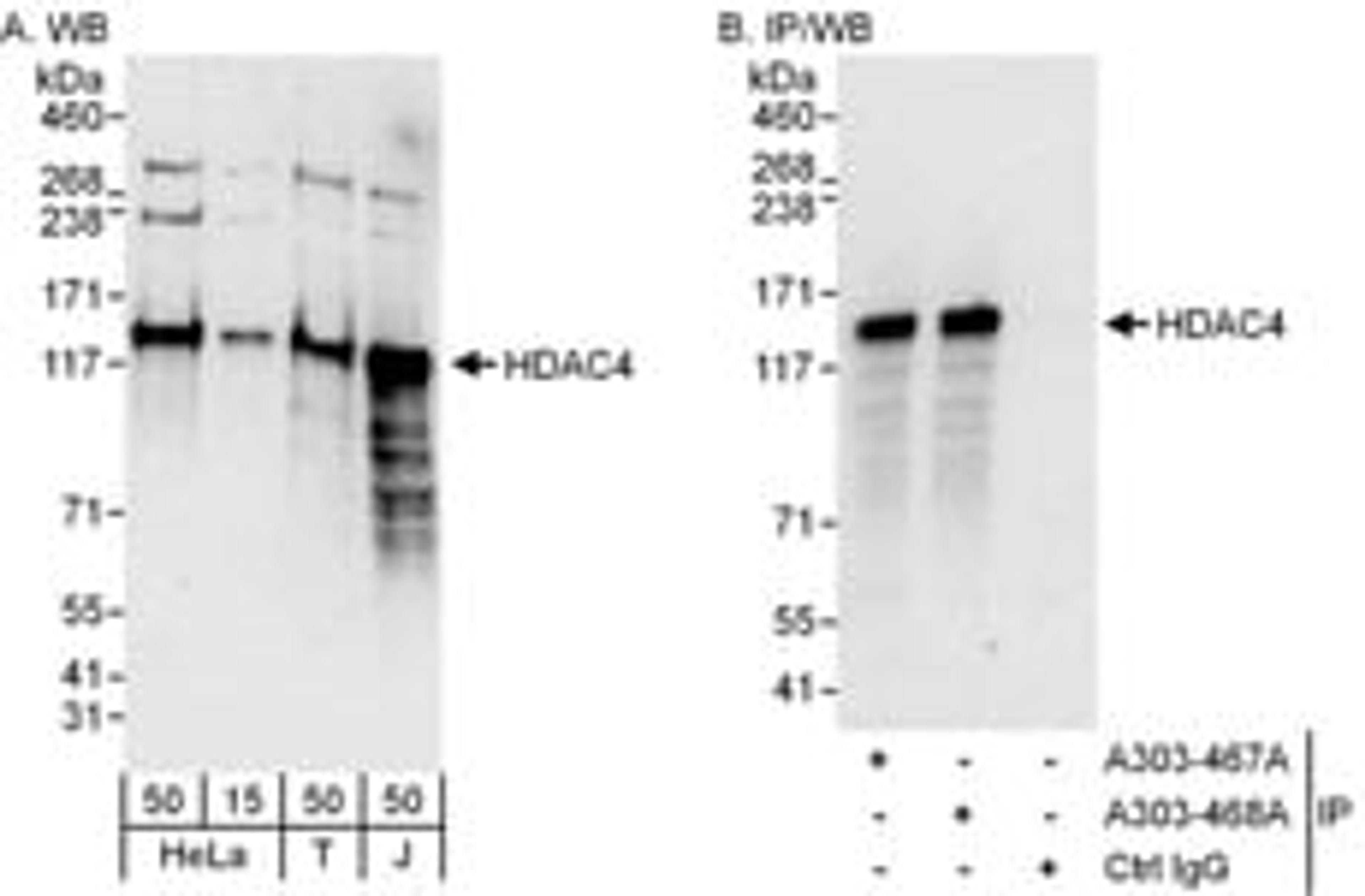 Detection of human HDAC4 by western blot and immunoprecipitation.