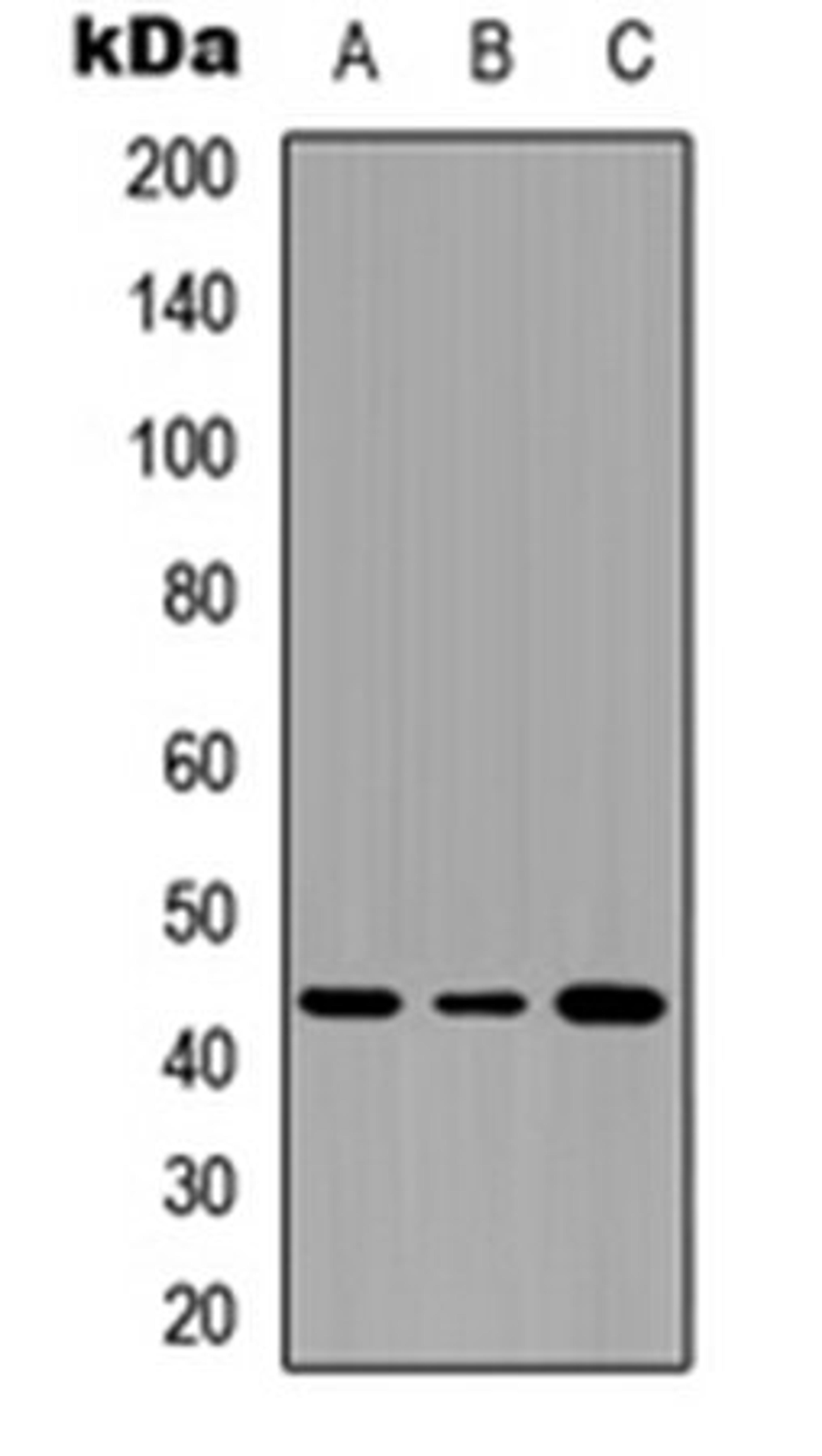 Western blot analysis of THP1 (Lane 1), NS-1 (Lane 2), PC12 (Lane 3) whole cell lysates using Serpin B3/4 antibody