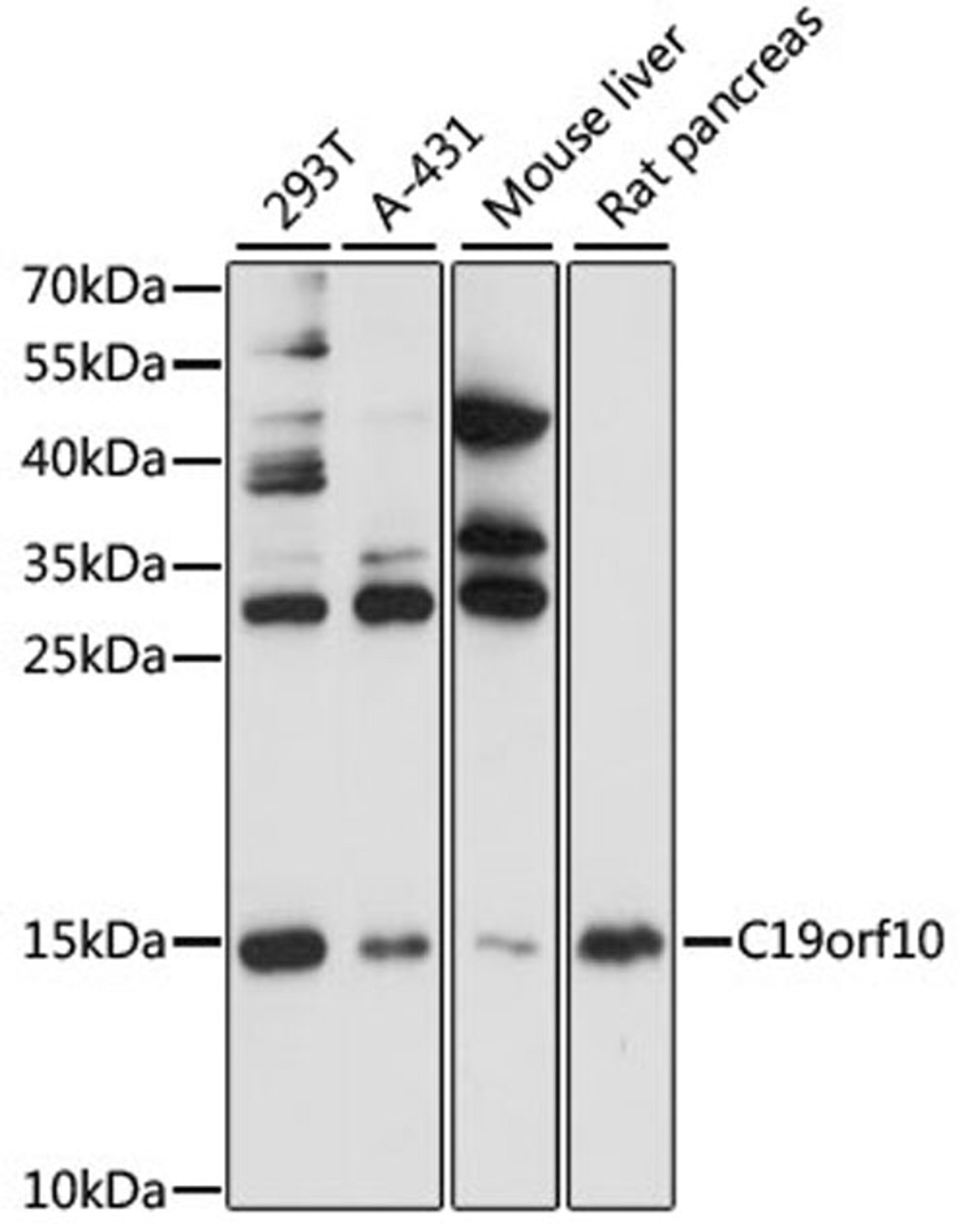 Western blot - C19orf10 antibody (A1093)