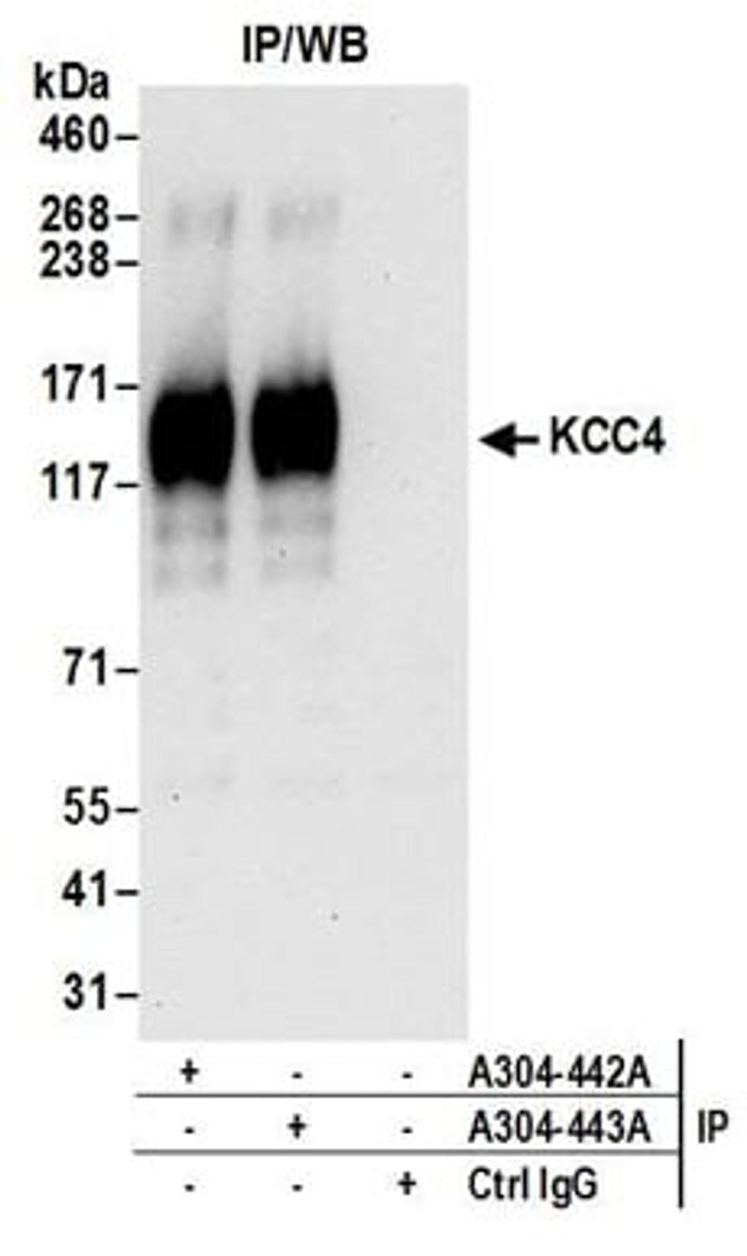 Detection of human KCC4 by western blot of immunoprecipitates.