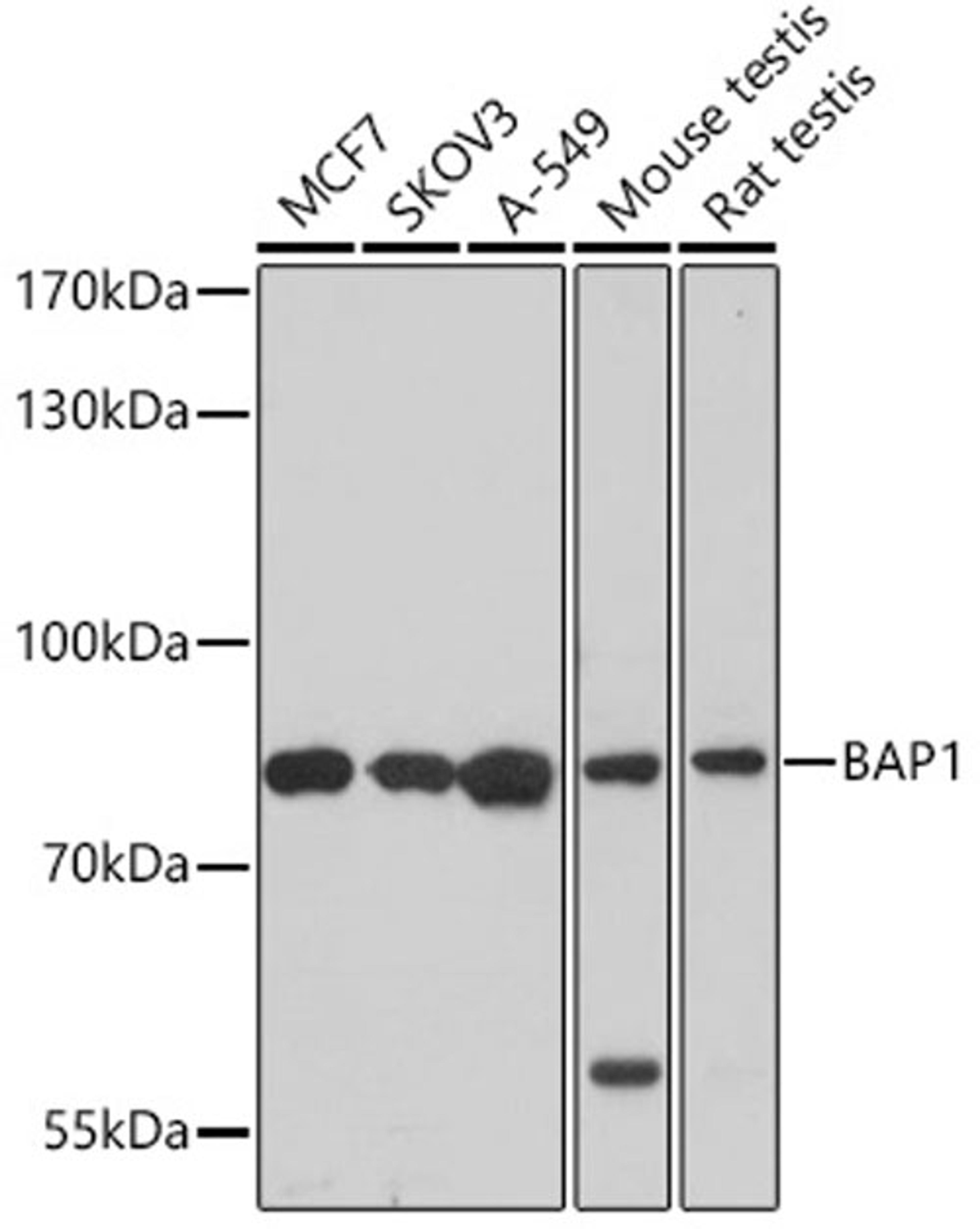 Immunohistochemistry  - BAP1 antibody (A6533)