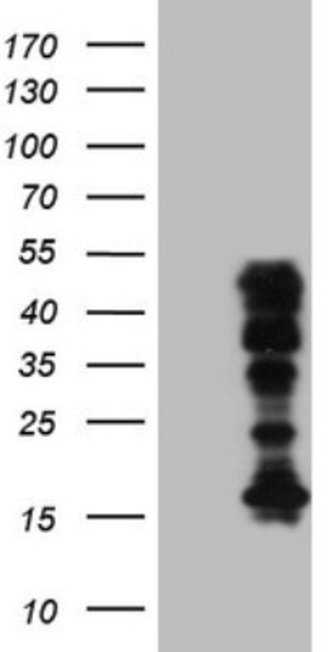 Western Blot: HOXC10 Antibody (5C10) [NBP2-46000] - Analysis of HEK293T cells were transfected with the pCMV6-ENTRY control (Left lane) or pCMV6-ENTRY HOXC10 .