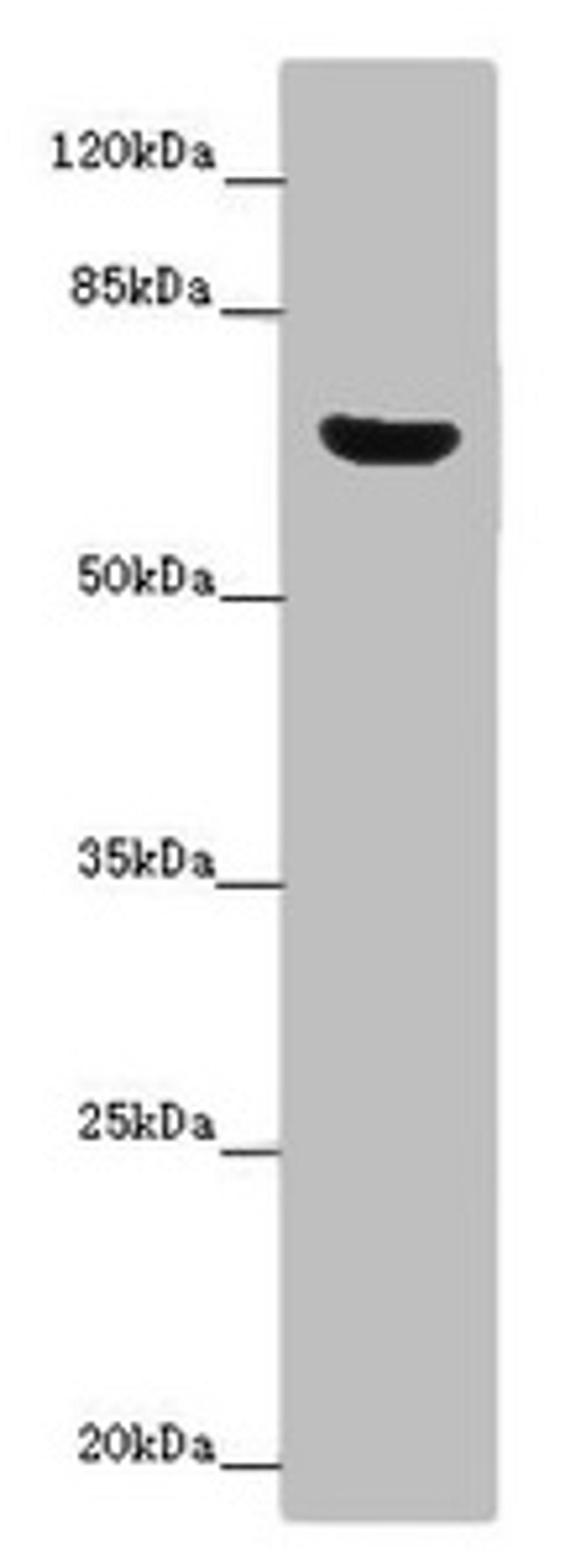 Western blot. All lanes: CERKL antibody at 14 ug/ml + Mouse lung tissue. Secondary. Goat polyclonal to rabbit IgG at 1/10000 dilution. Predicted band size: 63, 60, 53, 48, 43, 25, 20, 58 kDa. Observed band size: 63 kDa. 