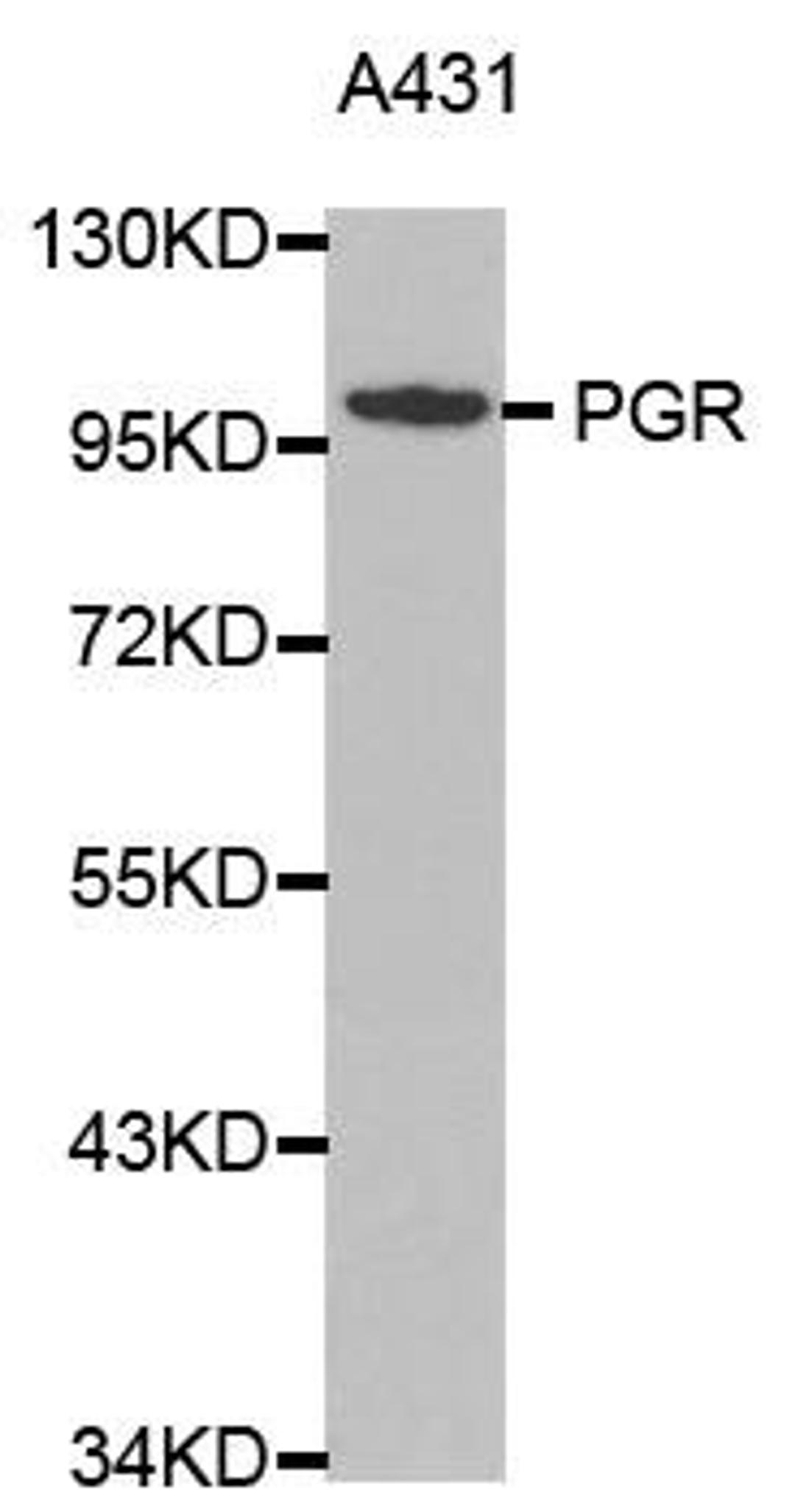 Western blot analysis of extracts of A431 cell lines using PGR antibody