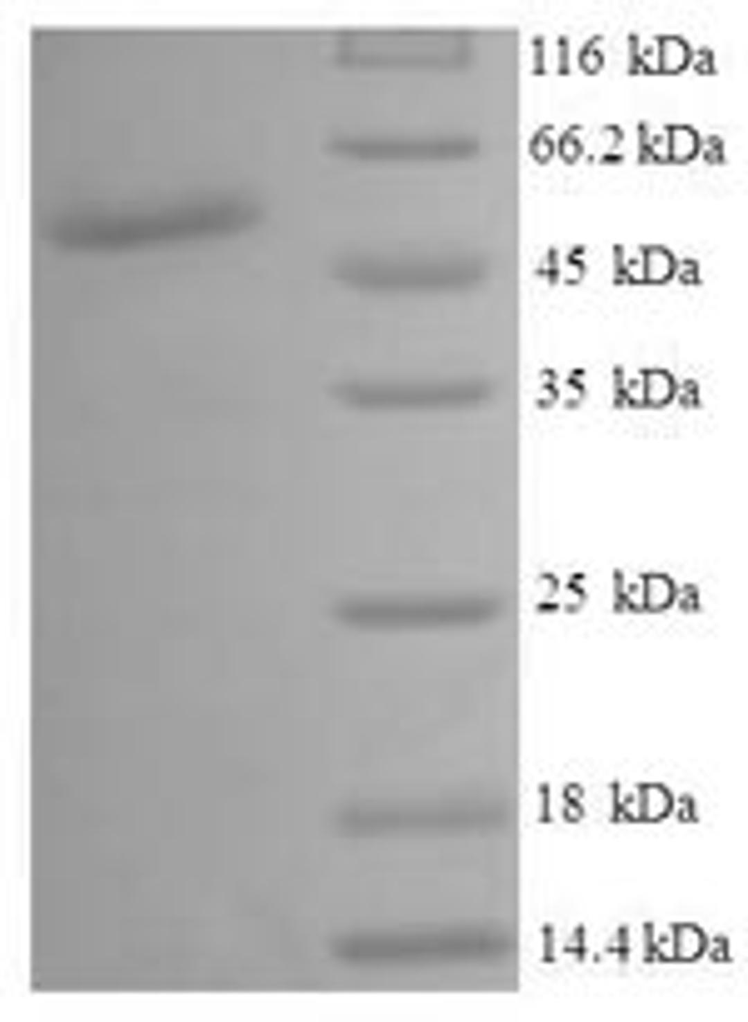 (Tris-Glycine gel) Discontinuous SDS-PAGE (reduced) with 5% enrichment gel and 15% separation gel.