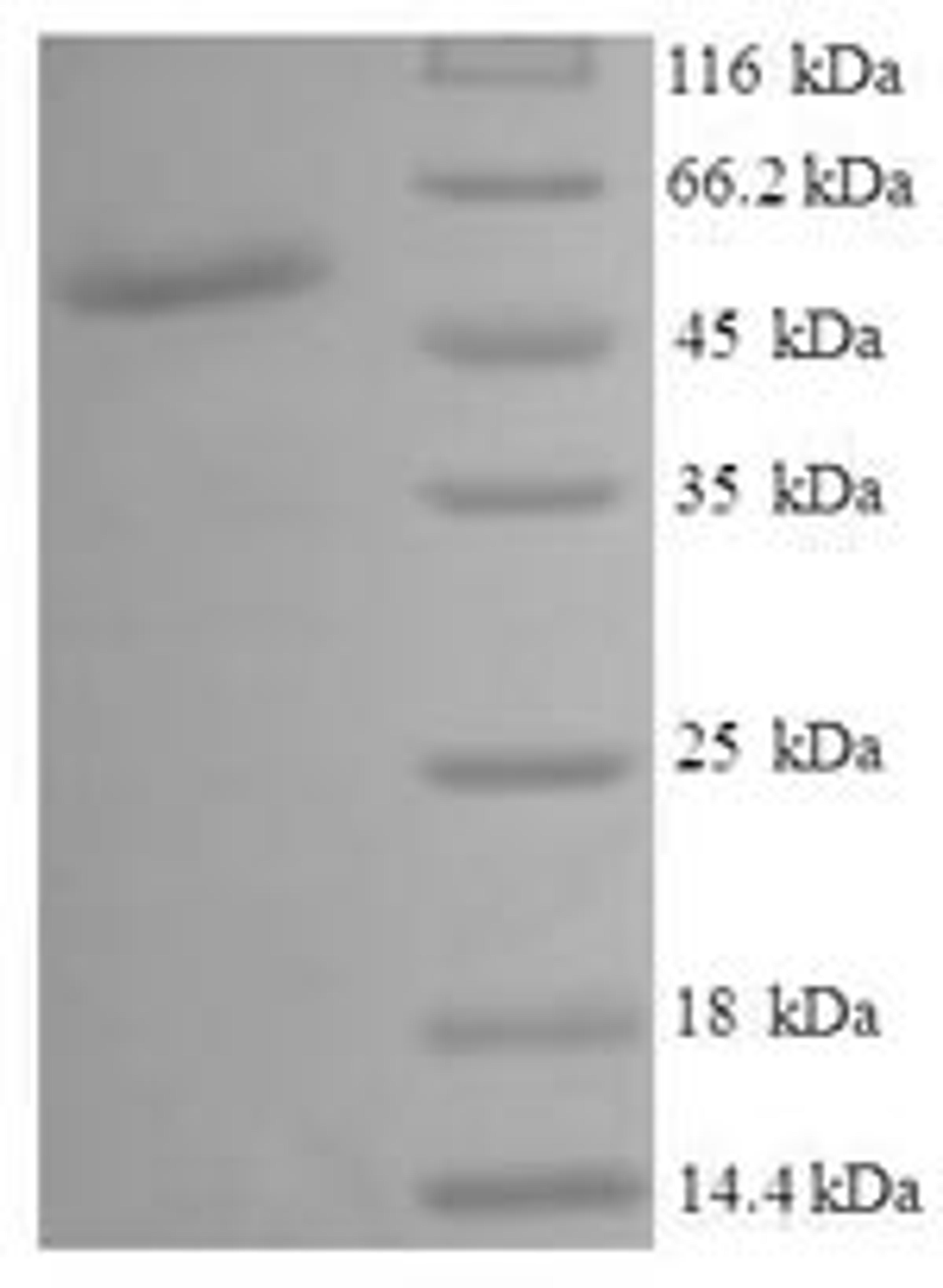(Tris-Glycine gel) Discontinuous SDS-PAGE (reduced) with 5% enrichment gel and 15% separation gel.