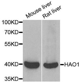 Western blot analysis of extracts of various cell lines using HAO1 antibody