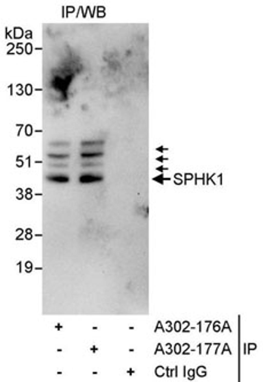 Detection of human SPHK1 by western blot of immunoprecipitates.