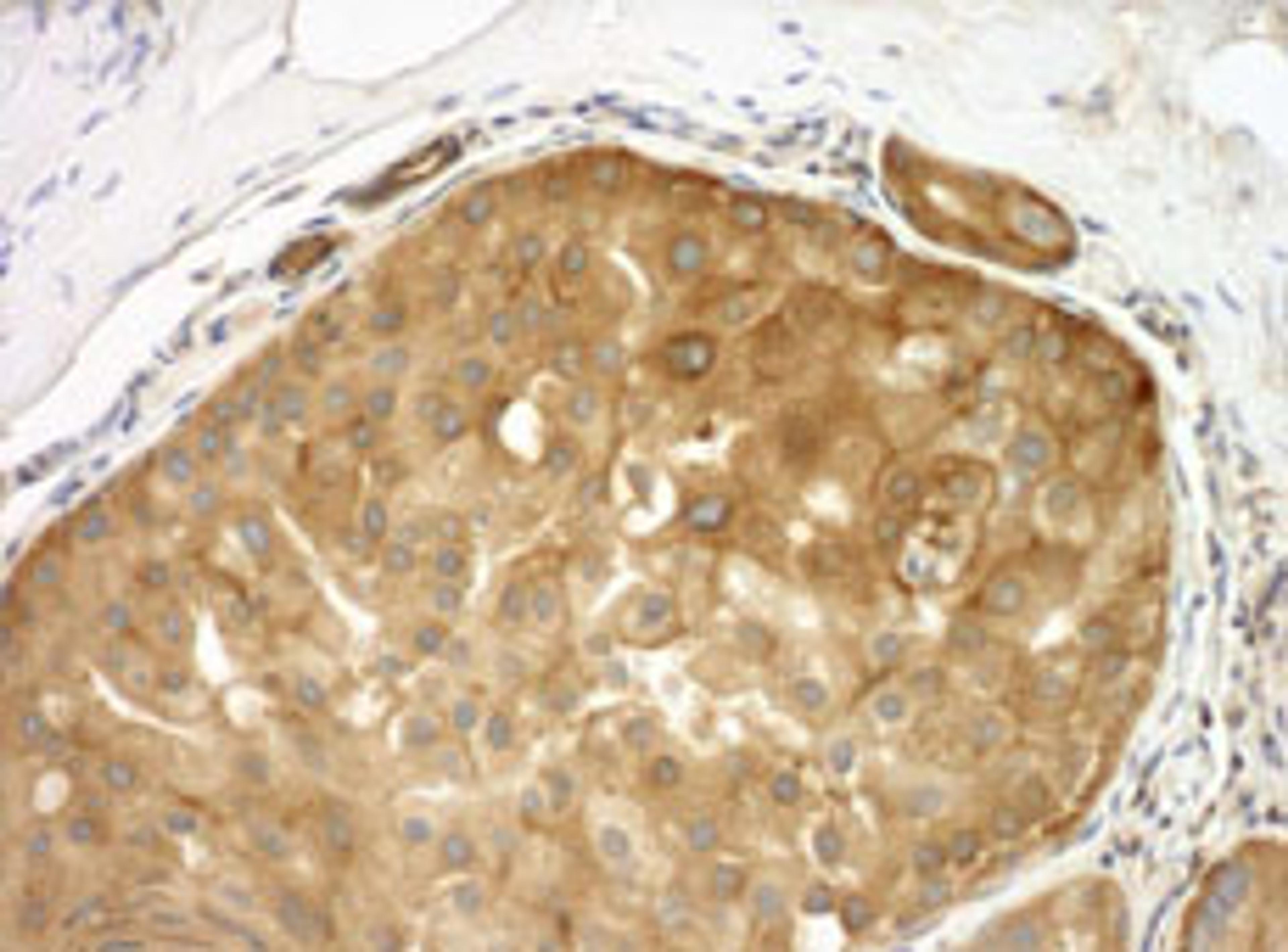 Detection of human Septin 9 by immunohistochemistry.