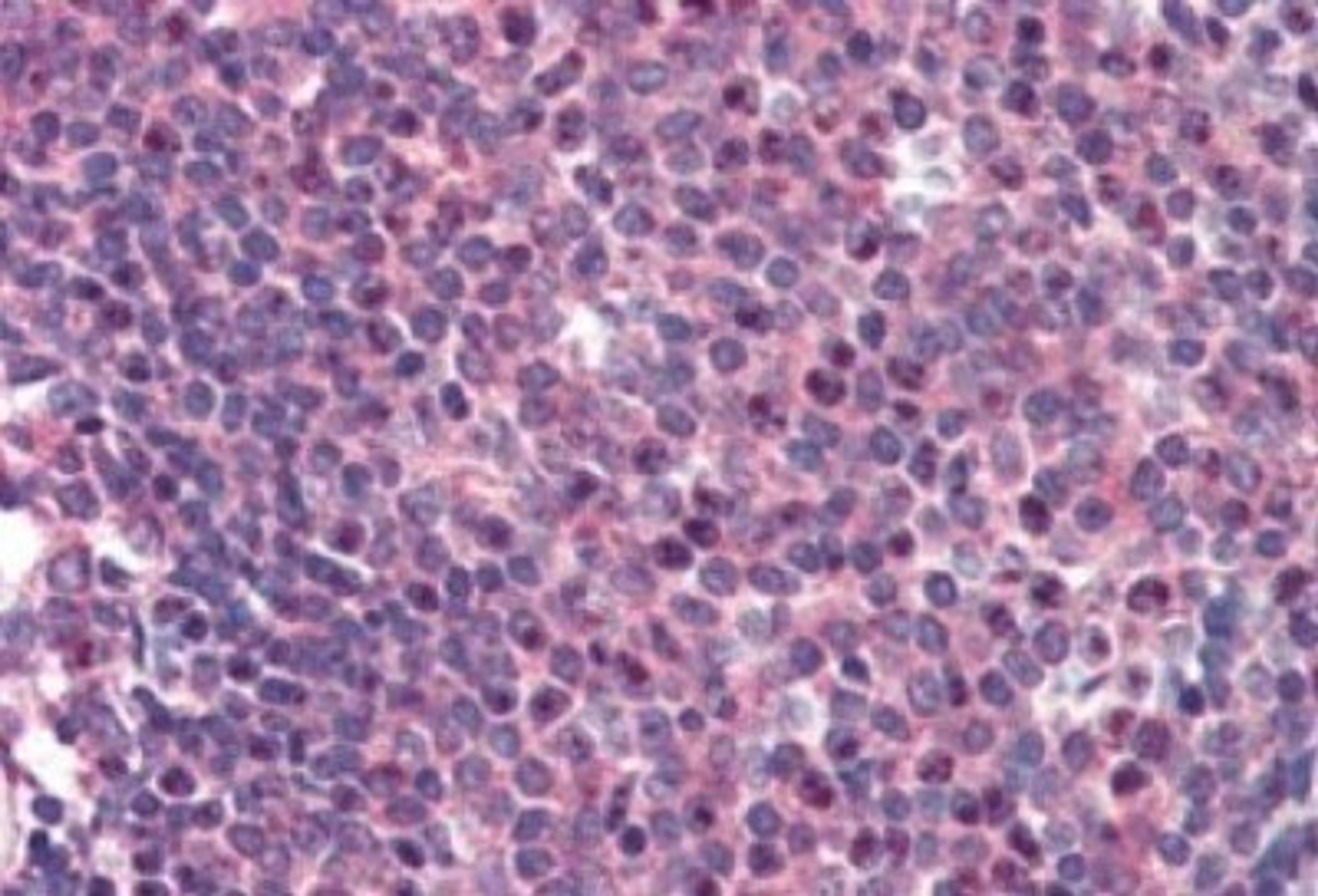 Immunohistochemistry-Paraffin: CARD11 Antibody [NB100-1200] - (2ug/ml) staining of paraffin embedded Human Spleen. Steamed antigen retrieval with citrate buffer pH 6, AP-staining.