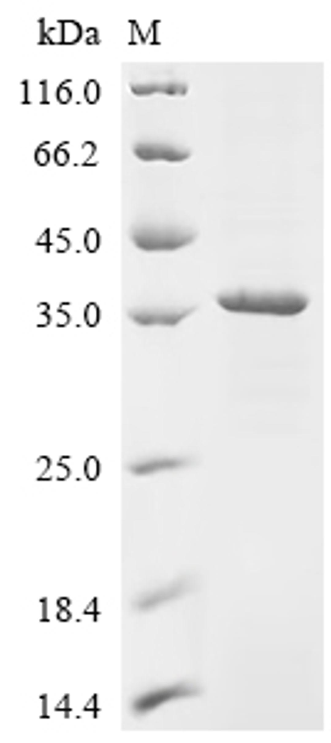 (Tris-Glycine gel) Discontinuous SDS-PAGE (reduced) with 5% enrichment gel and 15% separation gel.