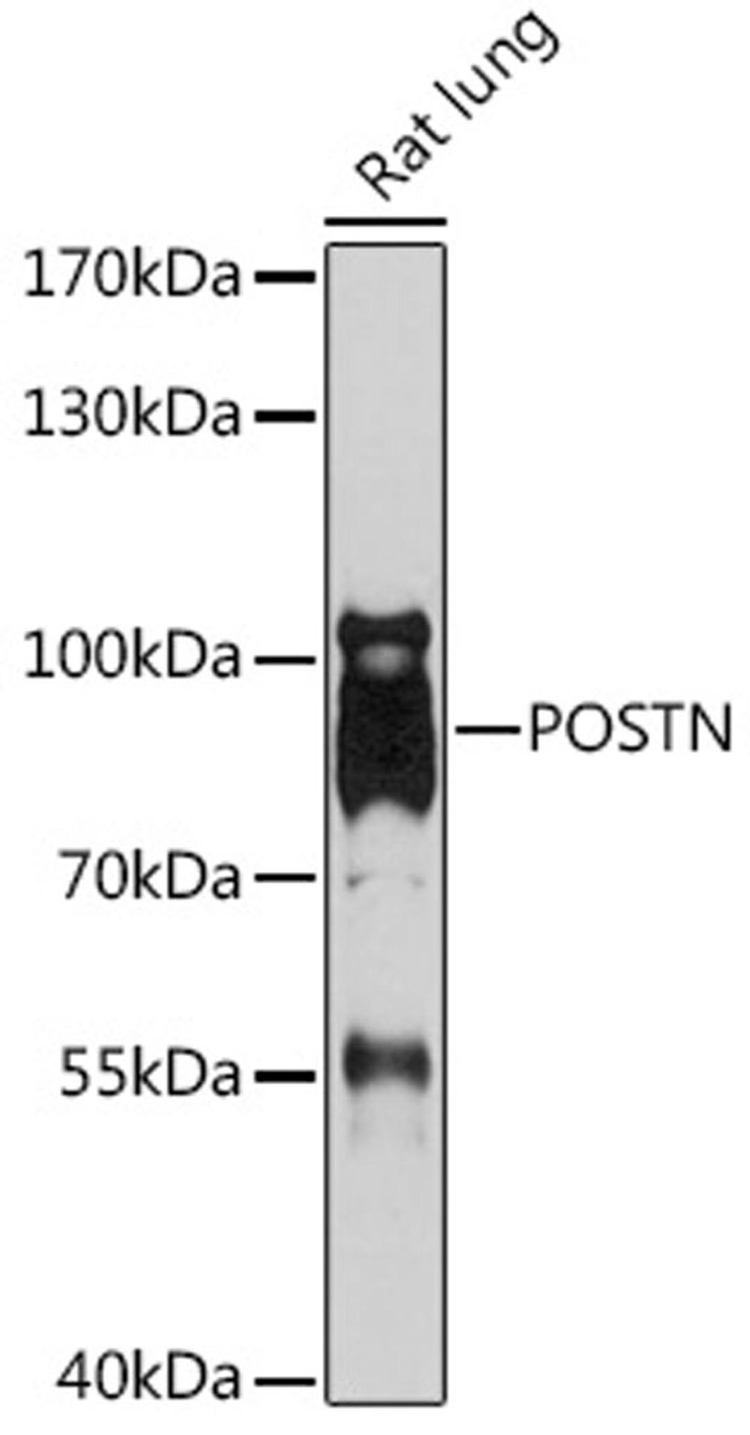 Western blot - POSTN antibody (A14556)