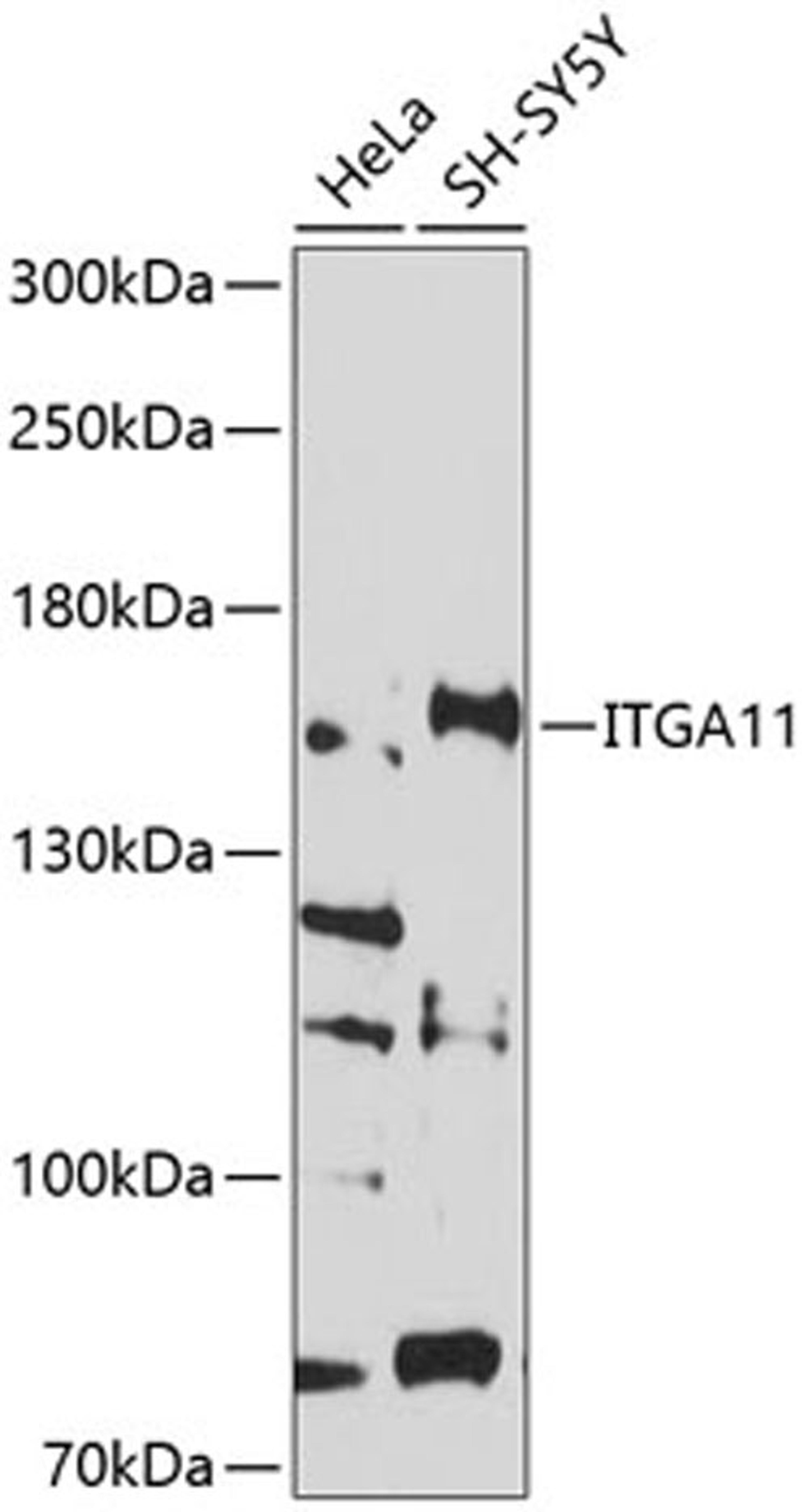 Western blot - ITGA11 antibody (A10084)