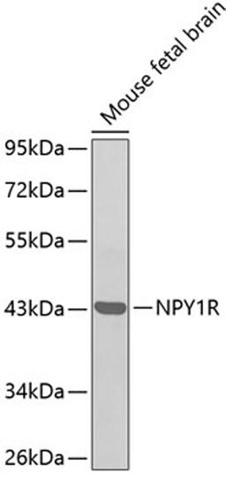 Western blot - NPY1R antibody (A3116)