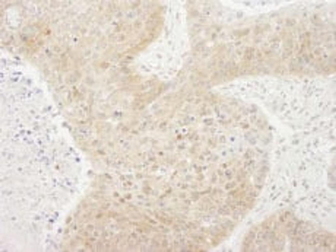 Detection of human TORC1 by immunohistochemistry.