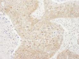 Detection of human TORC1 by immunohistochemistry.