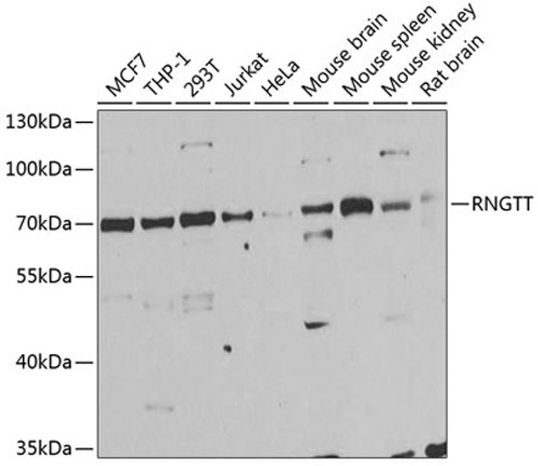 Western blot - RNGTT antibody (A6431)