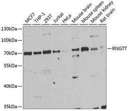 Western blot - RNGTT antibody (A6431)