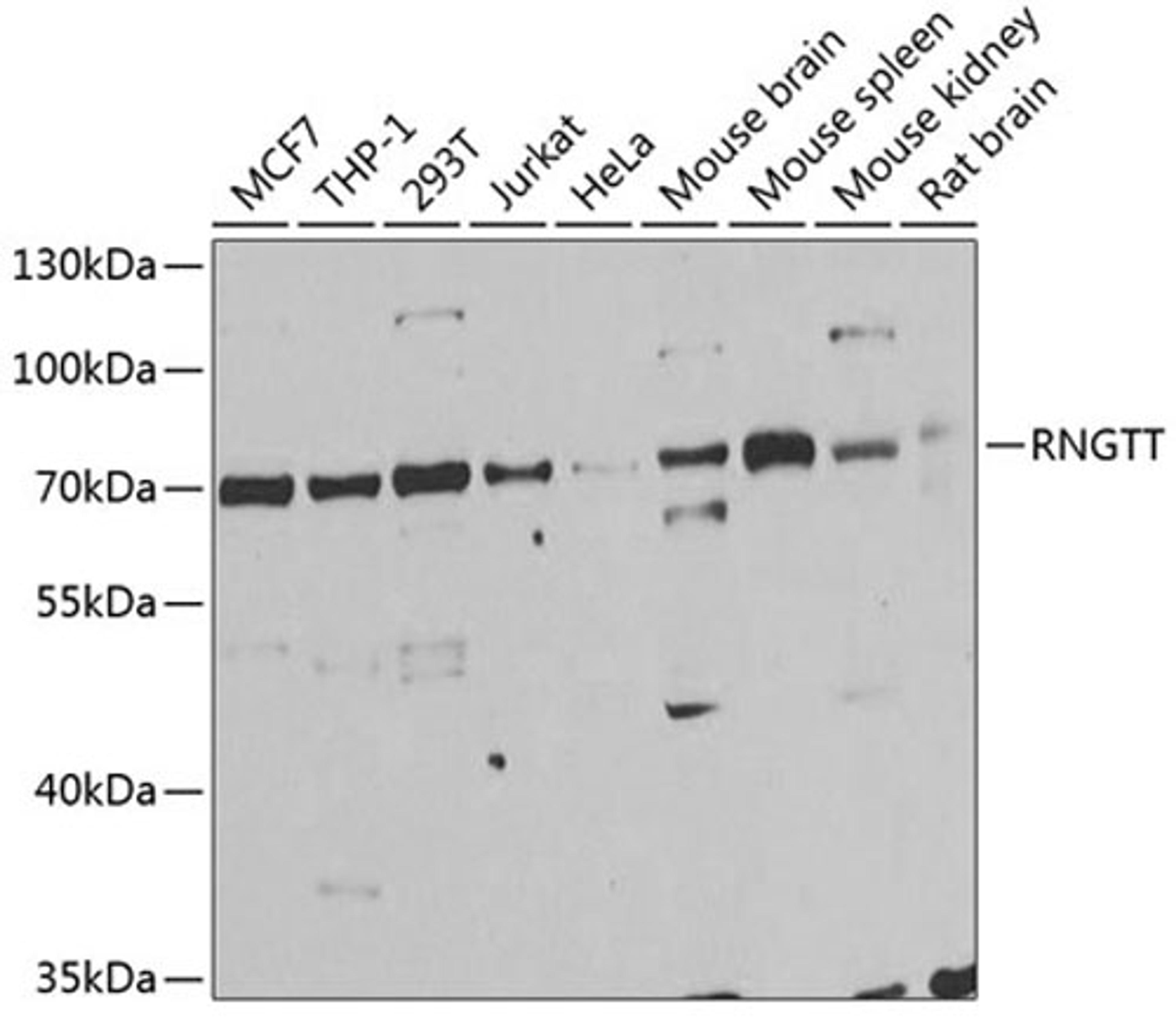 Western blot - RNGTT antibody (A6431)