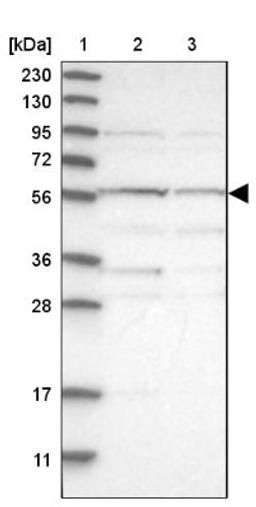 Western Blot: TRIM5 Antibody [NBP1-87119] - Lane 1: Marker [kDa] 230, 130, 95, 72, 56, 36, 28, 17, 11<br/>Lane 2: Human cell line RT-4<br/>Lane 3: Human cell line U-251MG sp