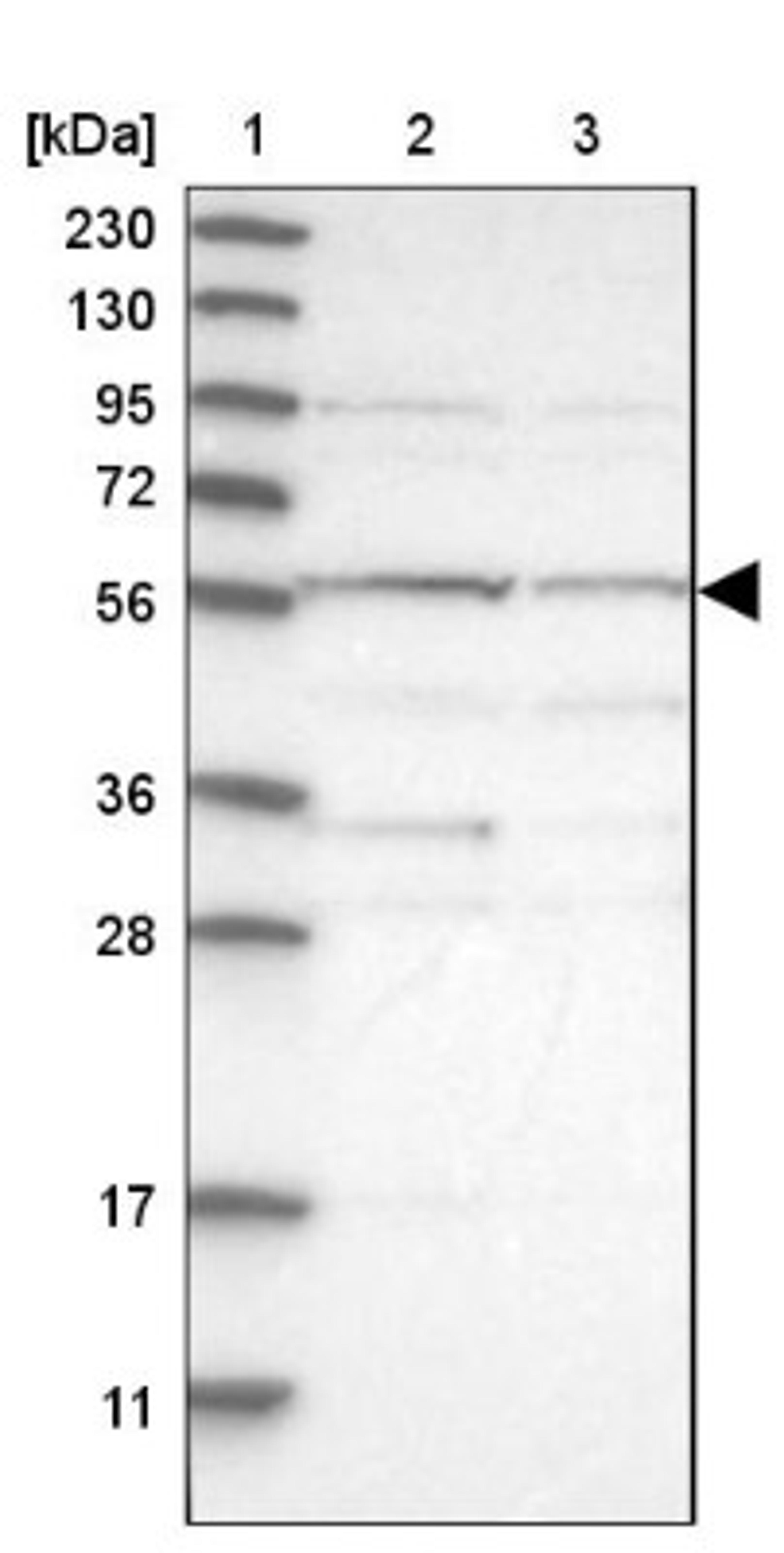 Western Blot: TRIM5 Antibody [NBP1-87119] - Lane 1: Marker [kDa] 230, 130, 95, 72, 56, 36, 28, 17, 11<br/>Lane 2: Human cell line RT-4<br/>Lane 3: Human cell line U-251MG sp