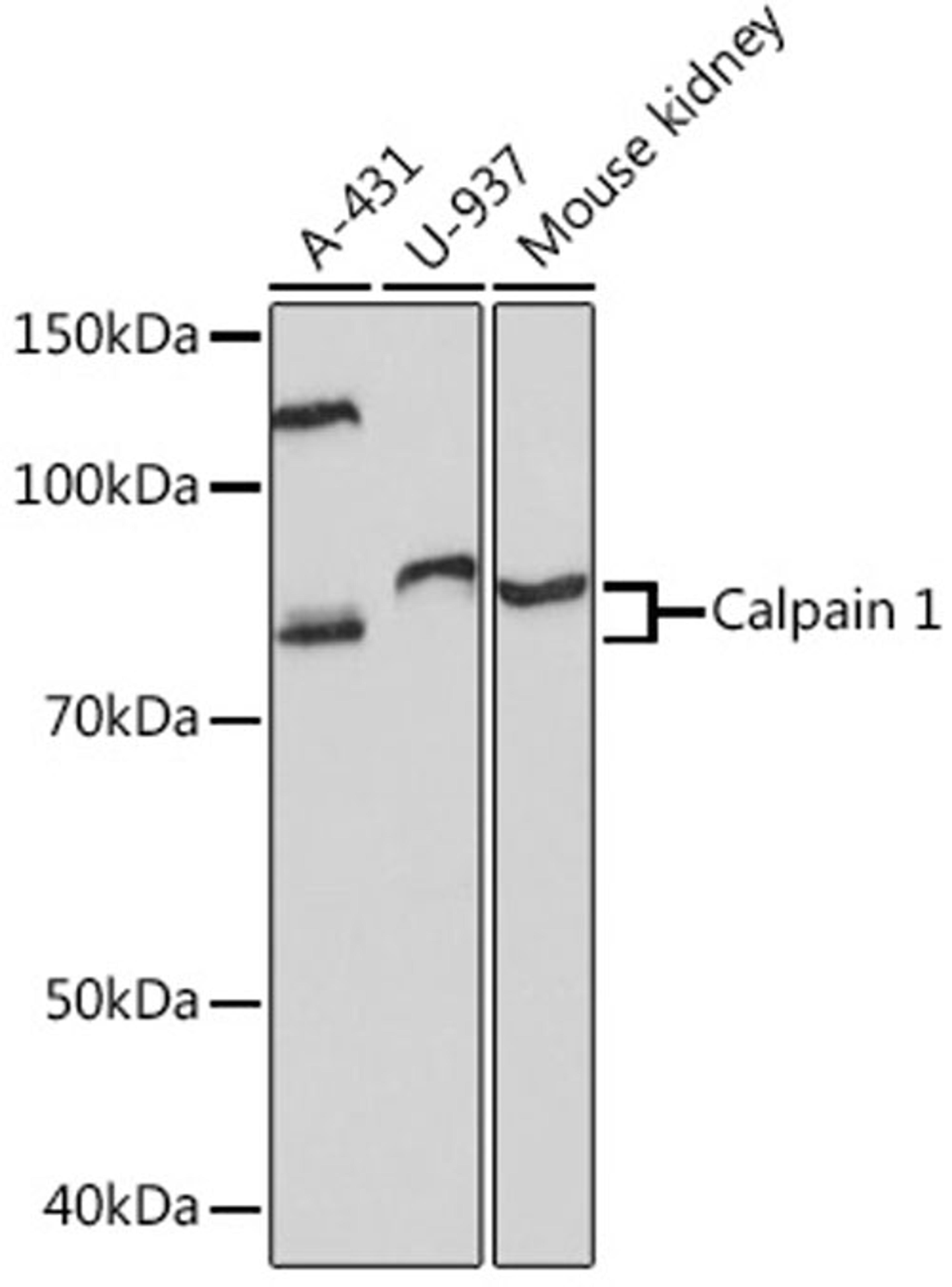 Western blot - Calpain 1 Rabbit mAb (A8710)