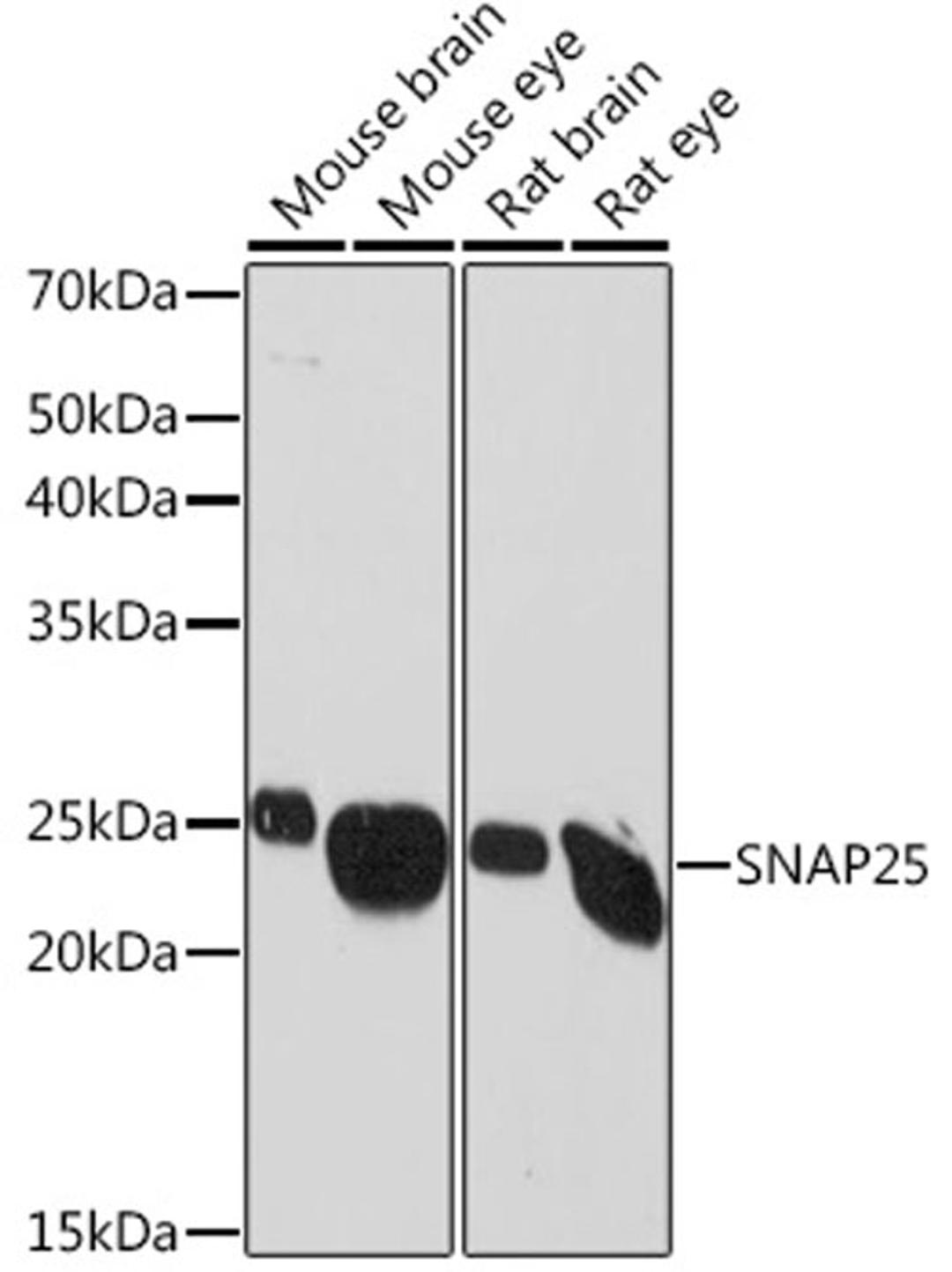 Western blot - SNAP25 Rabbit mAb (A2234)