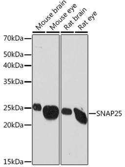 Western blot - SNAP25 Rabbit mAb (A2234)