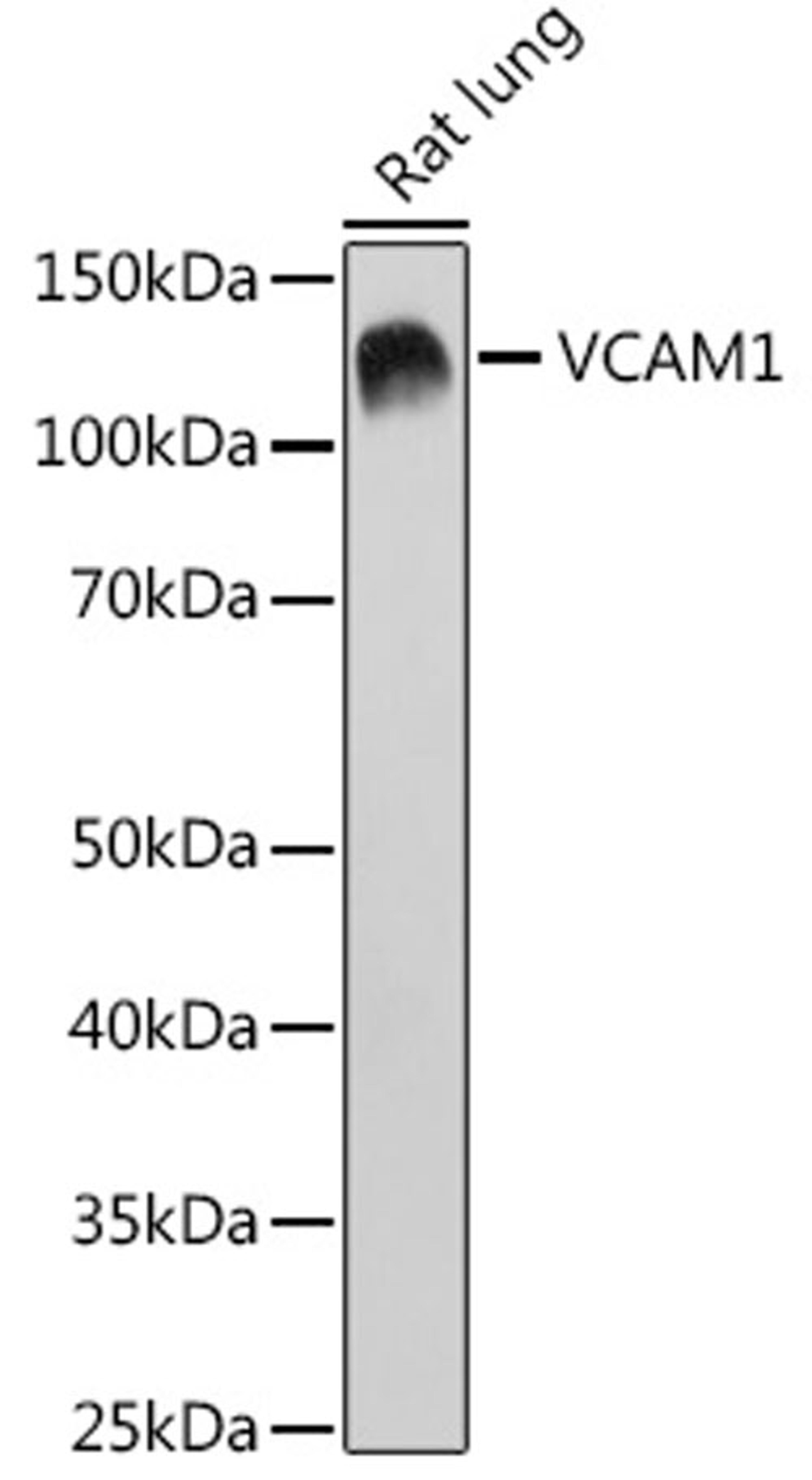 Western blot - VCAM1 pAb (A19131)