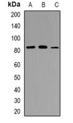 Western blot analysis of HeLa (Lane1), RAW264.7 (Lane2), PC12 (Lane3) whole cell lysates using TAGAP antibody