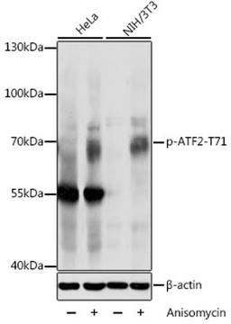 Western blot - Phospho-ATF2-T71 antibody (AP0020)