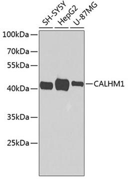 Western blot - CALHM1 antibody (A7858)