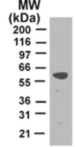 Western Blot: TRAF2 Antibody (33A1293) [NB100-56715] - analysis of TRAF2 in HeLa lysate using TRAF2 antibody at 2 ug/ml.