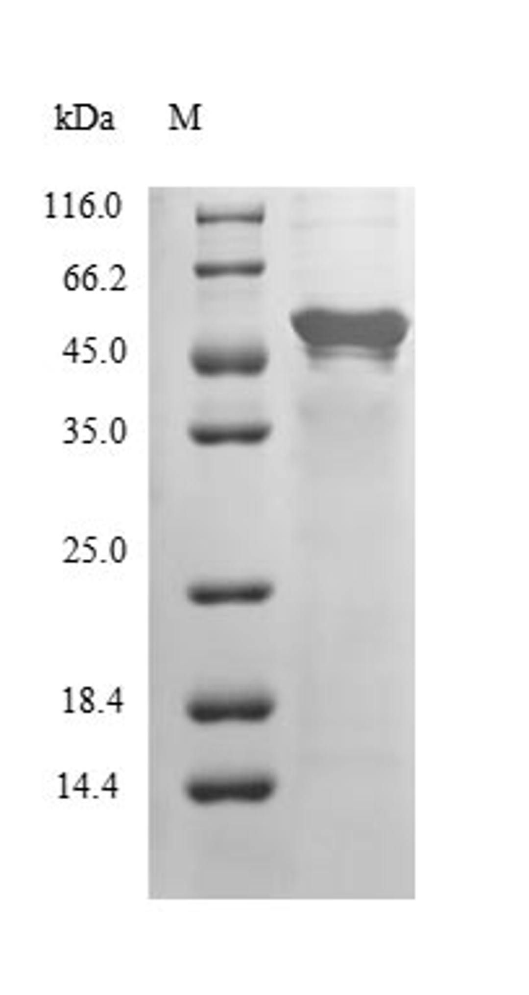 (Tris-Glycine gel) Discontinuous SDS-PAGE (reduced) with 5% enrichment gel and 15% separation gel.
