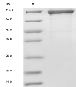 (Tris-Glycine gel) Discontinuous SDS-PAGE (reduced) with 5% enrichment gel and 15% separation gel.
