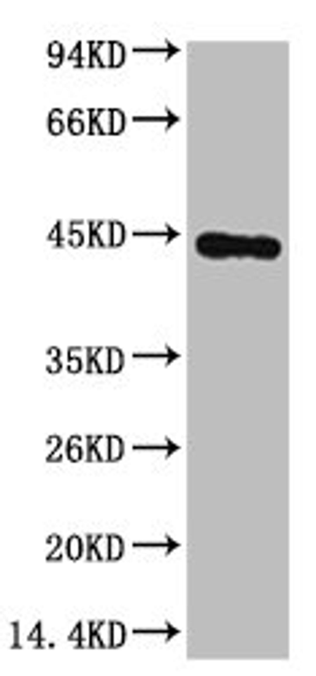 Western blot analysis of Hela, diluted at 1:3000.